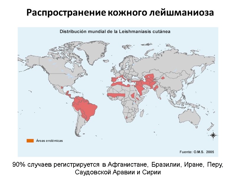 Распространение кожного лейшманиоза 90% случаев регистрируется в Афганистане, Бразилии, Иране, Перу, Саудовской Аравии и